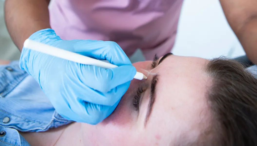 Benefits of Dermal Fillers treatment