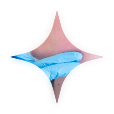 Jawline anti-wrinkle treatment