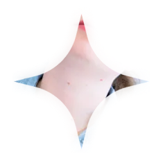 Neck lines anti-wrinkle treatment