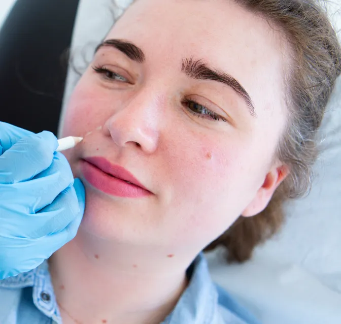 Anti-wrinkle treatment consultation