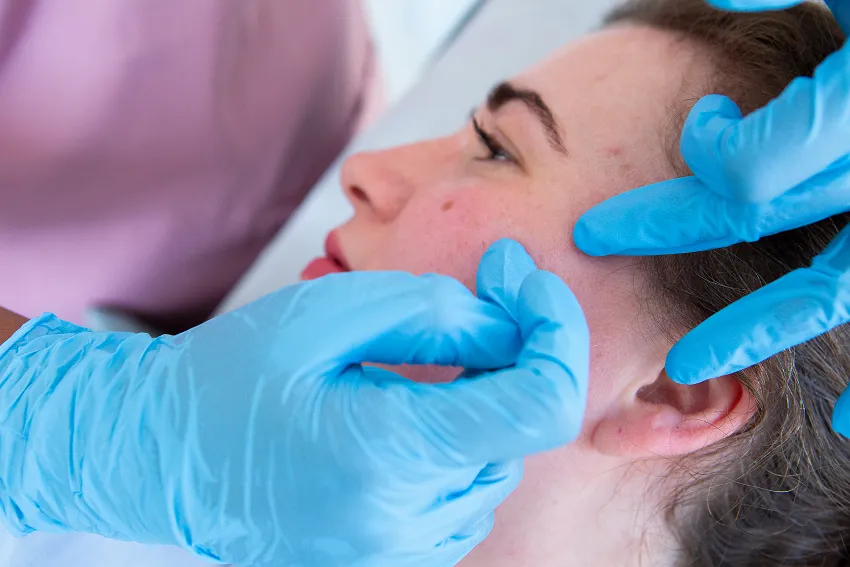 Skin Peel Treatment Chester