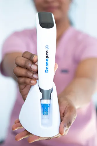 Dermapen treatment