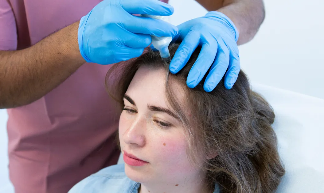 Dermapen microneedling in Chester