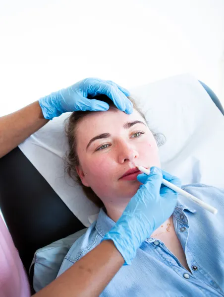 Lip Fillers in Chester