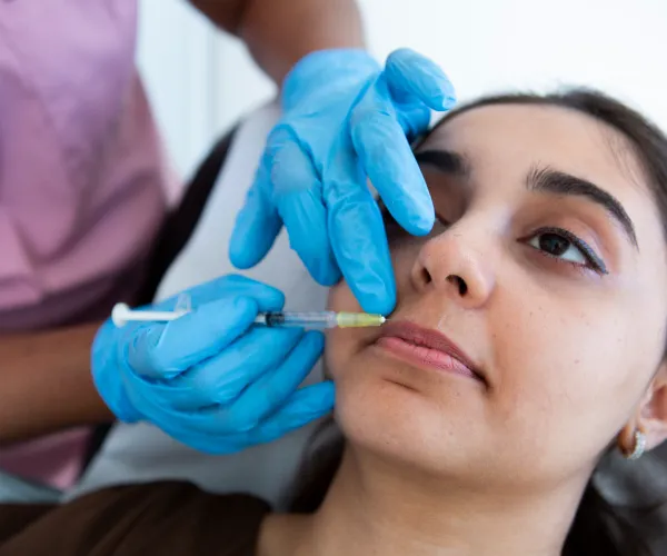 Non-surgical Marionette Lines treatment