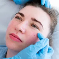 Cheek Enhancement