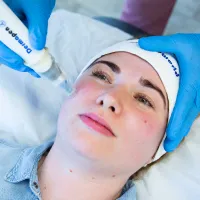 Dermapen Microneedling