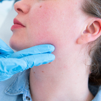 Jawline Contouring